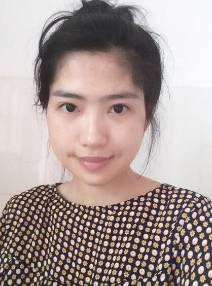 下頜角手術半個月