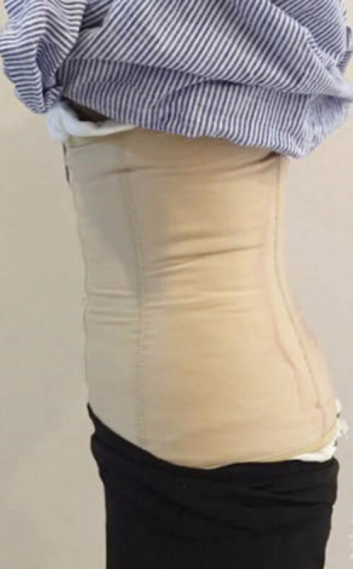 合肥壹加壹整形醫(yī)生周福田做腰腹吸脂技術(shù)怎么樣？附腰腹吸脂案例