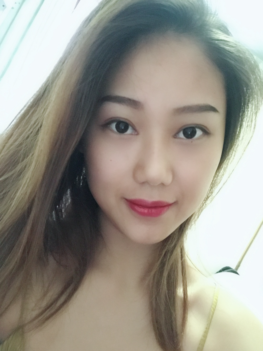 西安藝星整形醫(yī)院徐智慧醫(yī)生做埋線提升怎么樣？附西安藝星埋線提升案例