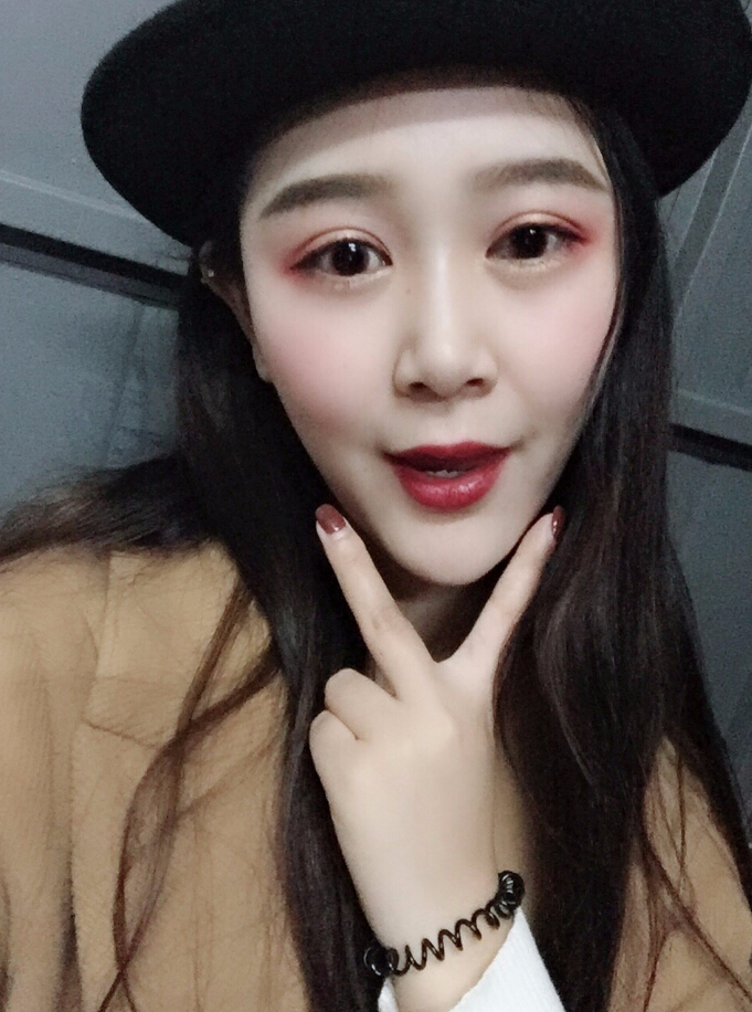 青島集美整形醫(yī)院做硅膠墊下巴怎么樣？趙煜楠醫(yī)生硅膠墊下巴真人案例