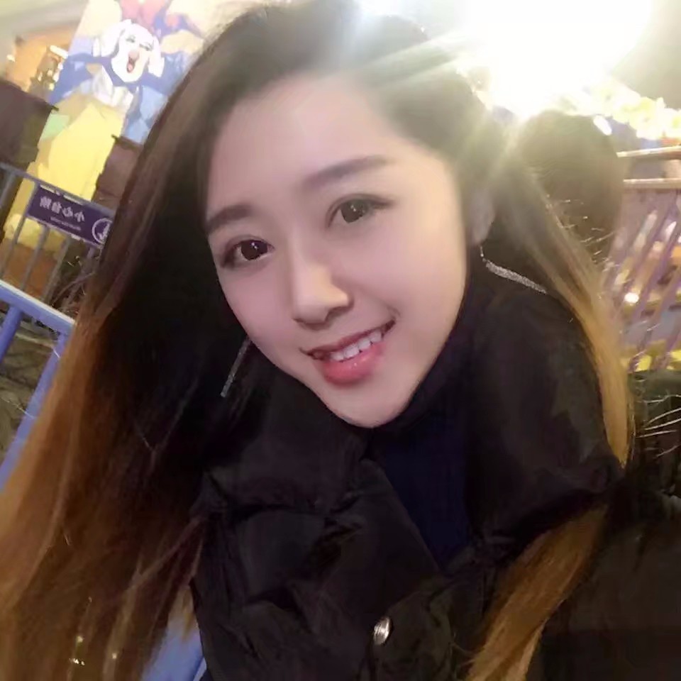 西安米蘭柏羽整形醫(yī)院李旭平做切開雙眼皮效果怎么樣？附案例