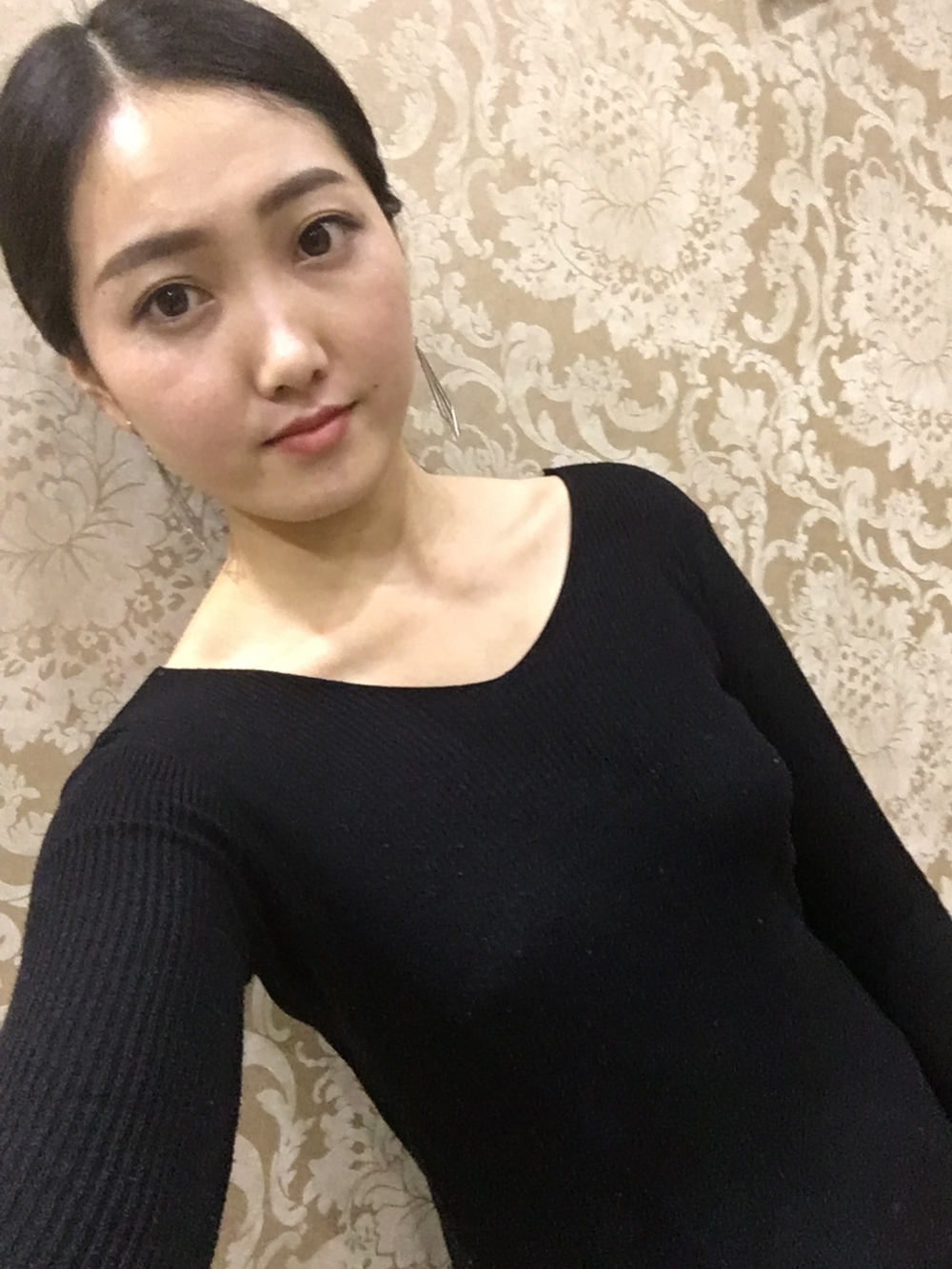 宜春美萊醫(yī)療整形醫(yī)生黃治林做自體脂肪隆胸怎么樣？附案例