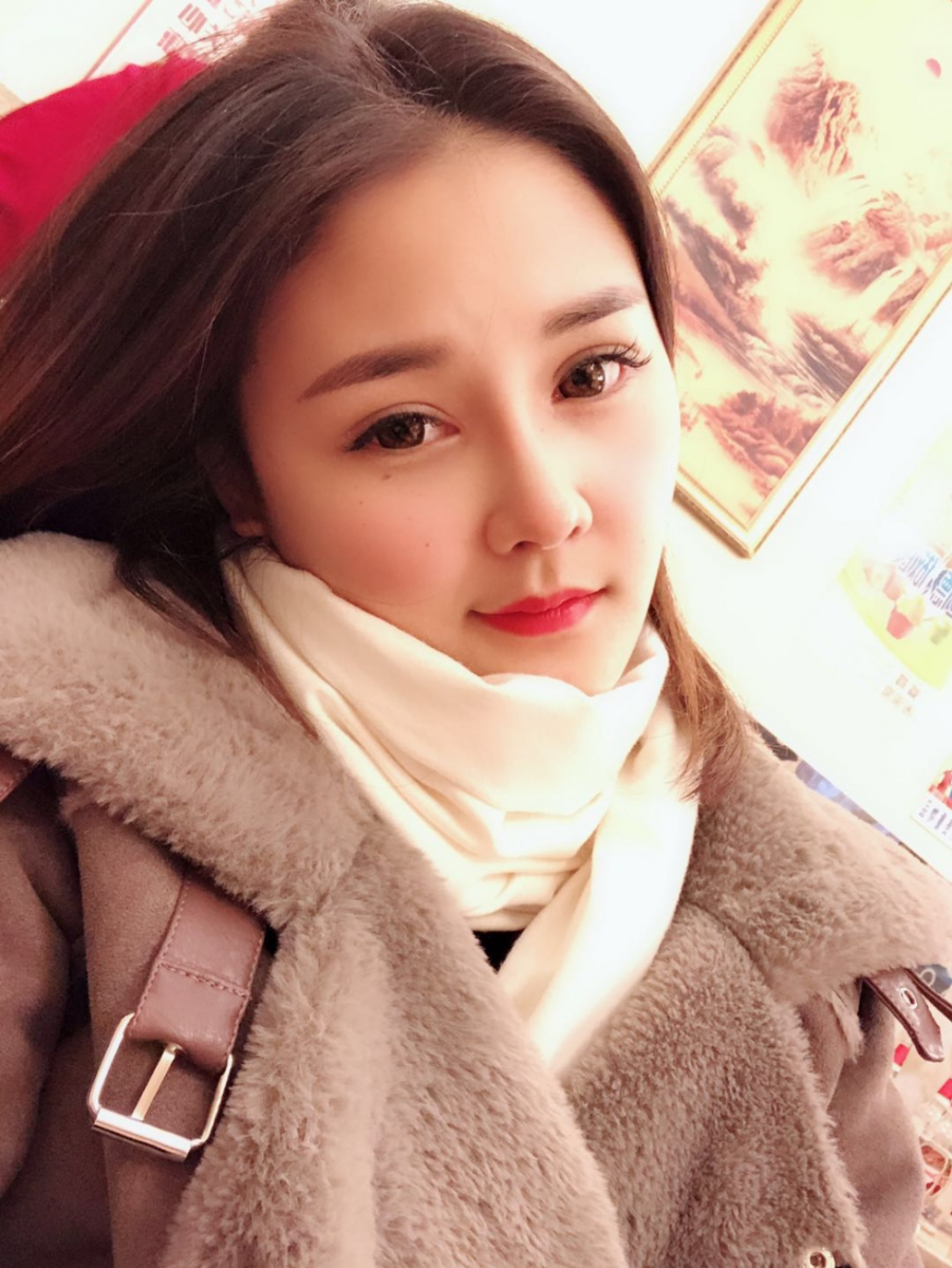 鄭州華領(lǐng)醫(yī)療美容醫(yī)院賀小虎醫(yī)生做眼綜合+鼻部整形手術(shù)效果怎么樣？