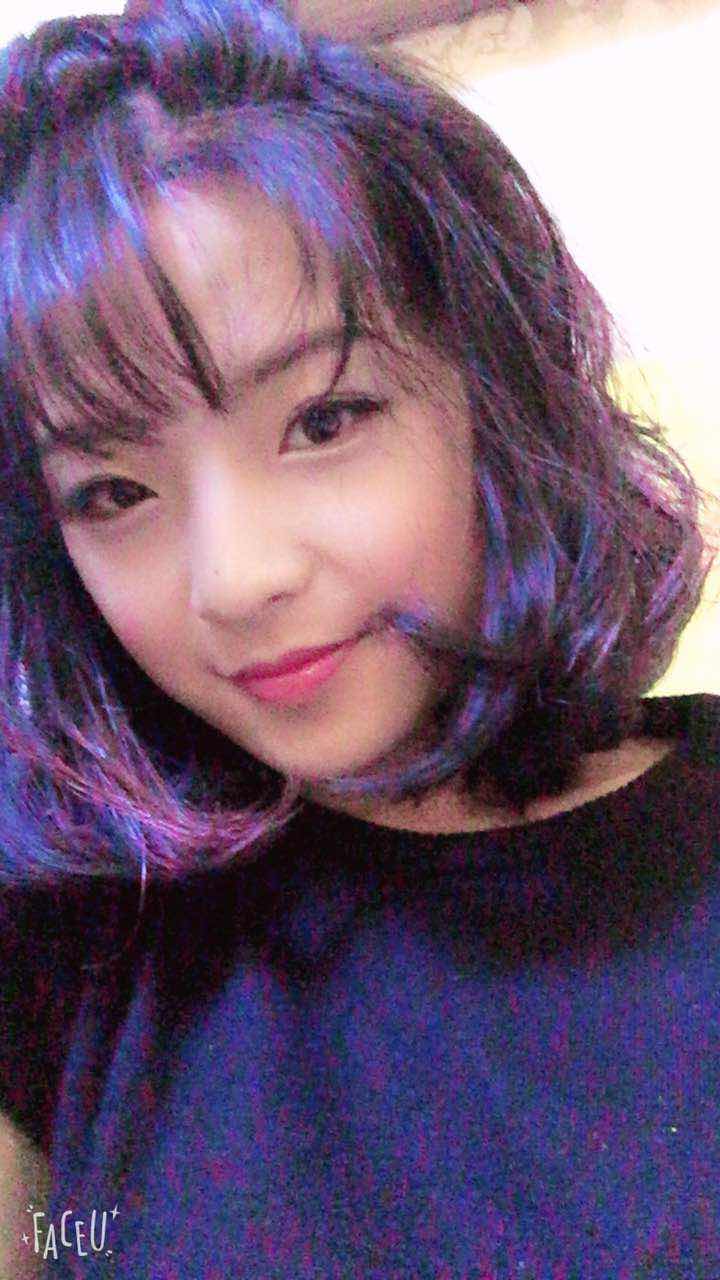 鄭州名門整形醫(yī)院董斌醫(yī)生做下頜角整形怎么樣？附下頜角整形案例