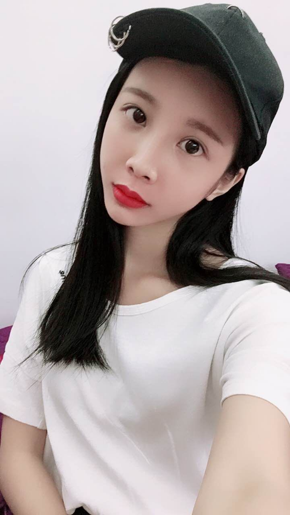 西安高一生醫(yī)療美容醫(yī)院網(wǎng)購(gòu)恒醫(yī)生做自體脂肪全臉填充案例效果對(duì)比圖