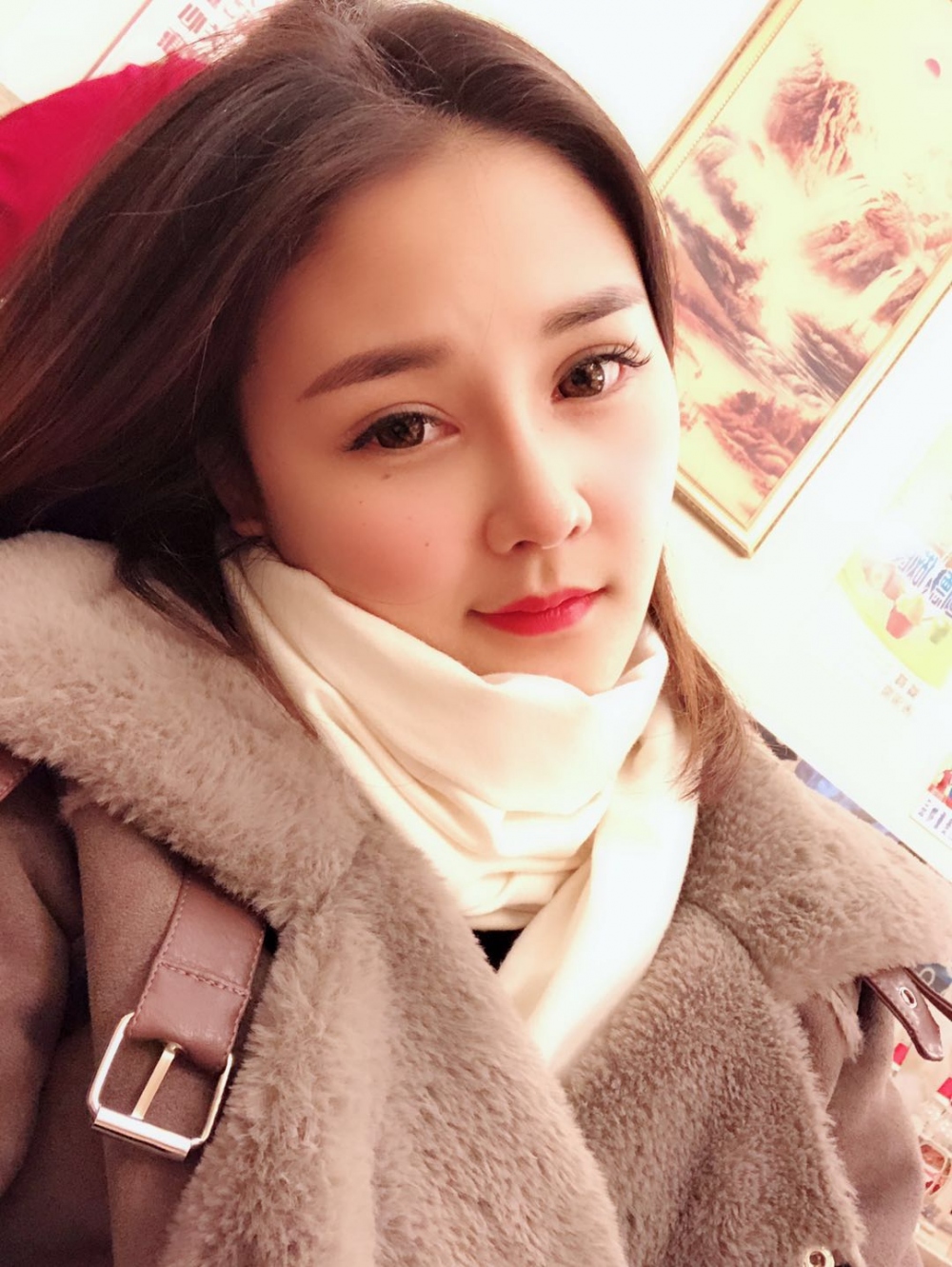 鄭州華領(lǐng)醫(yī)療美容醫(yī)院賀小虎醫(yī)生做眼綜合+鼻部整形手術(shù)效果怎么樣？