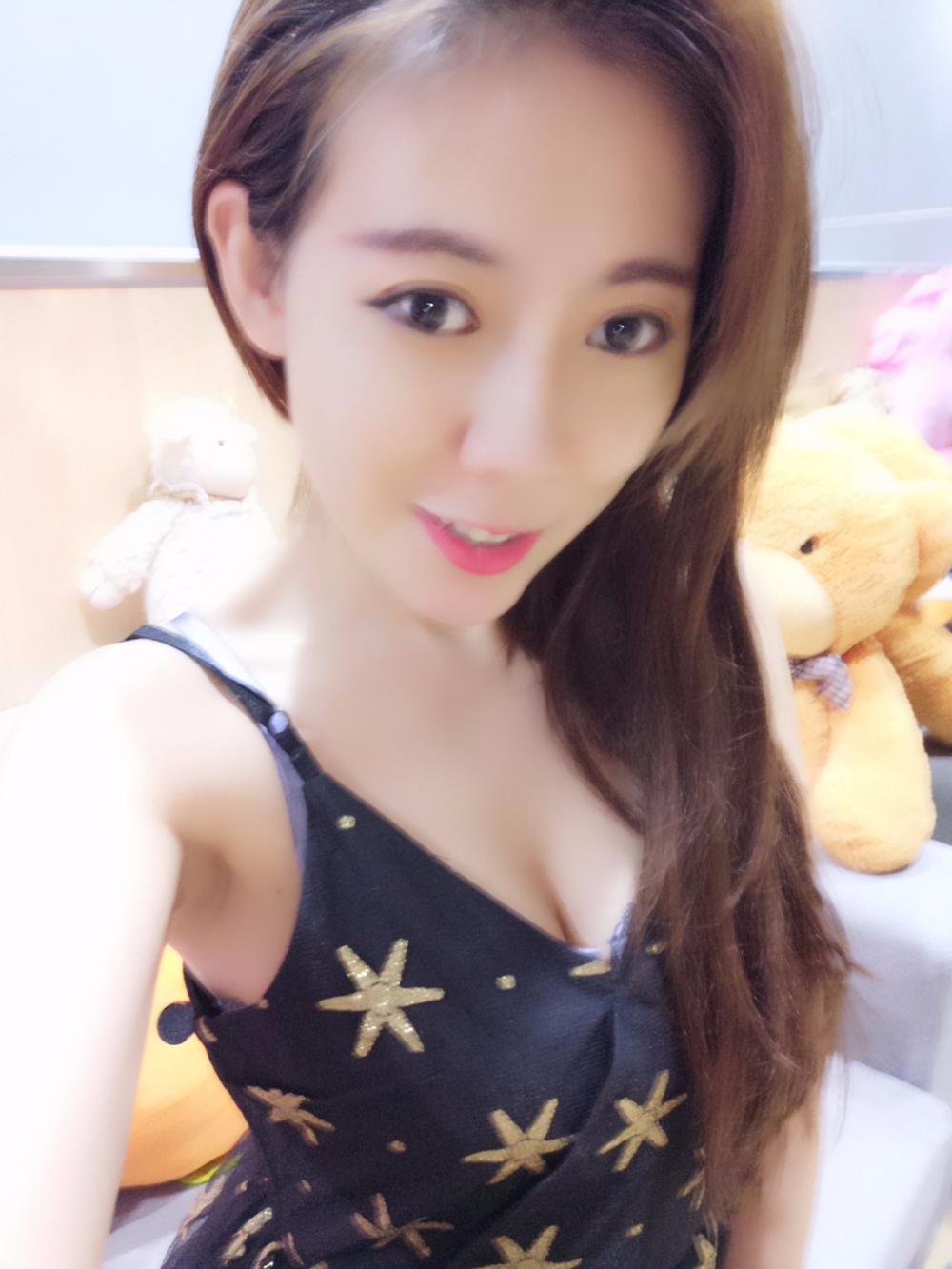 煙臺(tái)壹美整形醫(yī)院朱建瑩醫(yī)生做自體脂肪隆胸怎么樣？附自體脂肪隆胸案例