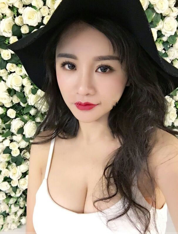 海南韓美醫(yī)學(xué)美容醫(yī)院李強(qiáng)醫(yī)生做自體脂肪隆胸效果怎么樣？附案例