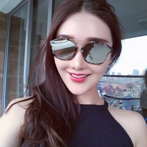 廣州柏德口腔蘭海龍醫(yī)生做瓷貼面效果怎么樣？廣州柏德口腔瓷貼面案例分享