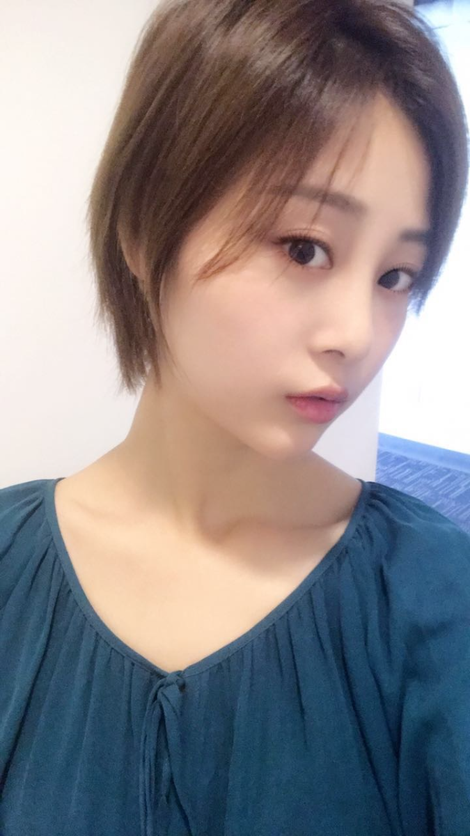 天津歐華威莎整形醫(yī)生姚玲做面部埋線提升效果怎么樣？附埋線提升案例