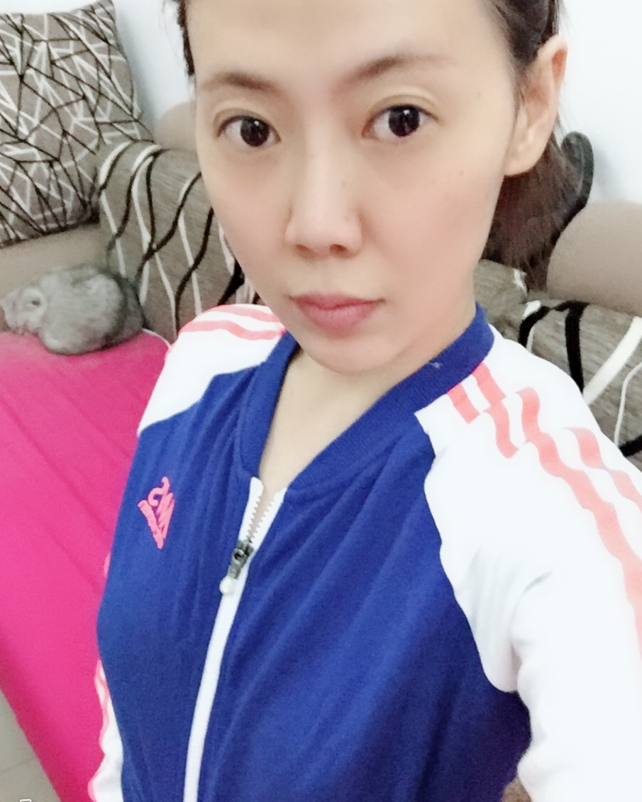 煙臺壹美整形醫(yī)院朱建瑩醫(yī)生做自體脂肪隆胸怎么樣？附自體脂肪隆胸案例