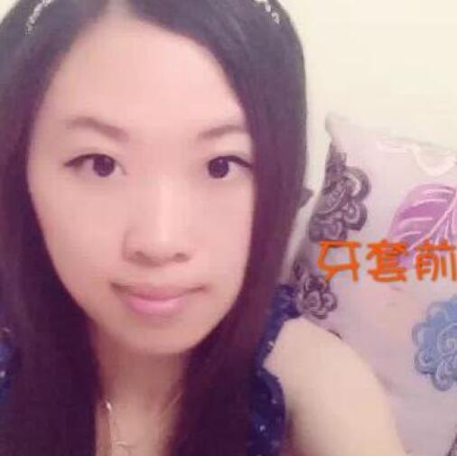 重慶嘉悅口腔醫(yī)院周繼祥醫(yī)生做金屬托槽矯正效果怎么樣？附案例效果對(duì)比圖