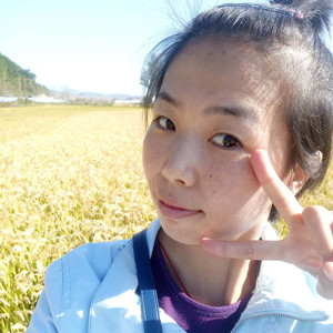 珠海蒂伊醫(yī)療整形醫(yī)生廖俊凱做激光祛斑效果怎么樣？附激光祛斑案例效果圖