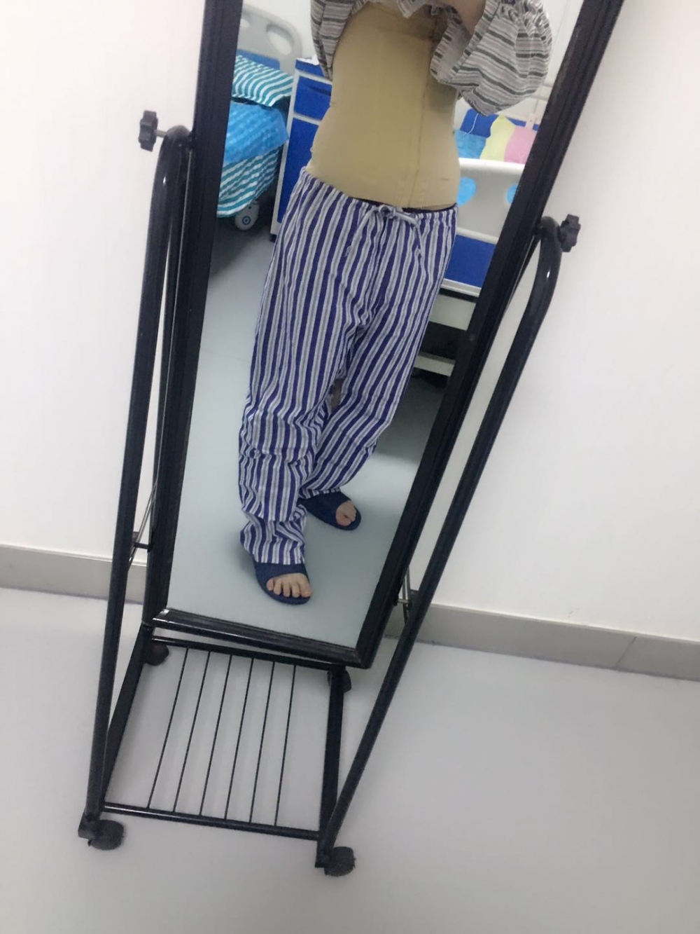肇慶華美整形醫(yī)院陳巍醫(yī)生做腰腹吸脂效果怎么樣？附腰腹吸脂案例