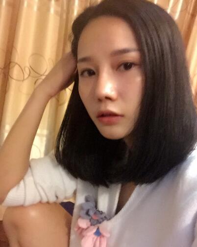 西安陽光整形醫(yī)院邵萍醫(yī)生做鼻綜合整形怎么樣？附鼻綜合整形案例