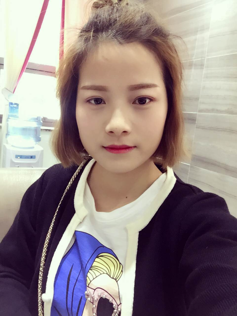 西安藝星醫(yī)療整形醫(yī)院李國(guó)玲做鼻綜合整形怎么樣？附李國(guó)玲鼻綜合整形案例