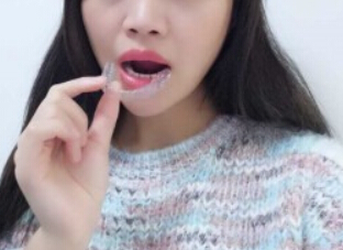 廈門拜博口腔醫(yī)院醫(yī)生張忠做牙齒隱形矯正怎么樣？附案例效果對比圖