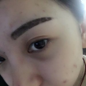 大同清木整形醫(yī)院張樹霞醫(yī)生做半永久紋眉效果如何？附半永久紋眉效果圖