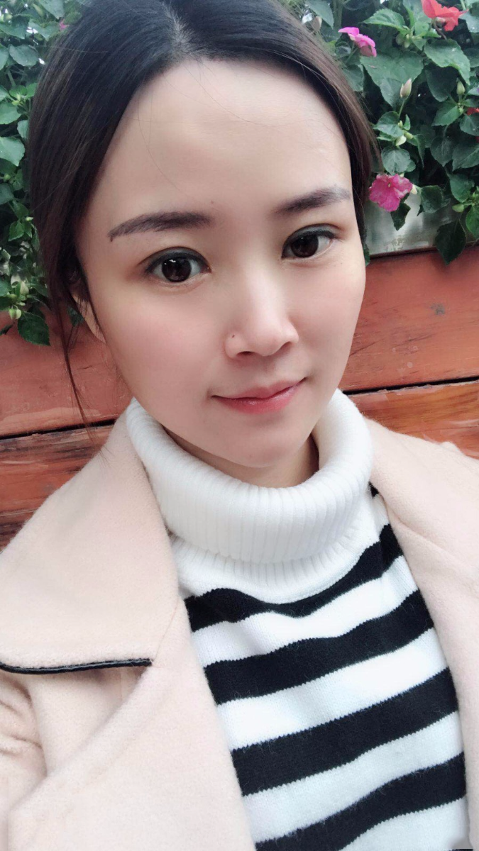 廣東韓妃醫(yī)療美容醫(yī)院做切開雙眼怎么樣？附案例效果圖