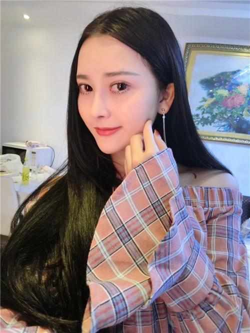 鄭州華領醫(yī)療美容醫(yī)院醫(yī)生張永濤做硅膠假體隆鼻怎么樣？附案例效果對比圖