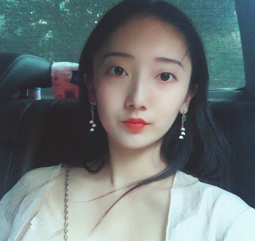 深圳鵬愛醫(yī)療美容醫(yī)院醫(yī)生文炯軫做埋線隆鼻怎么樣？附案例
