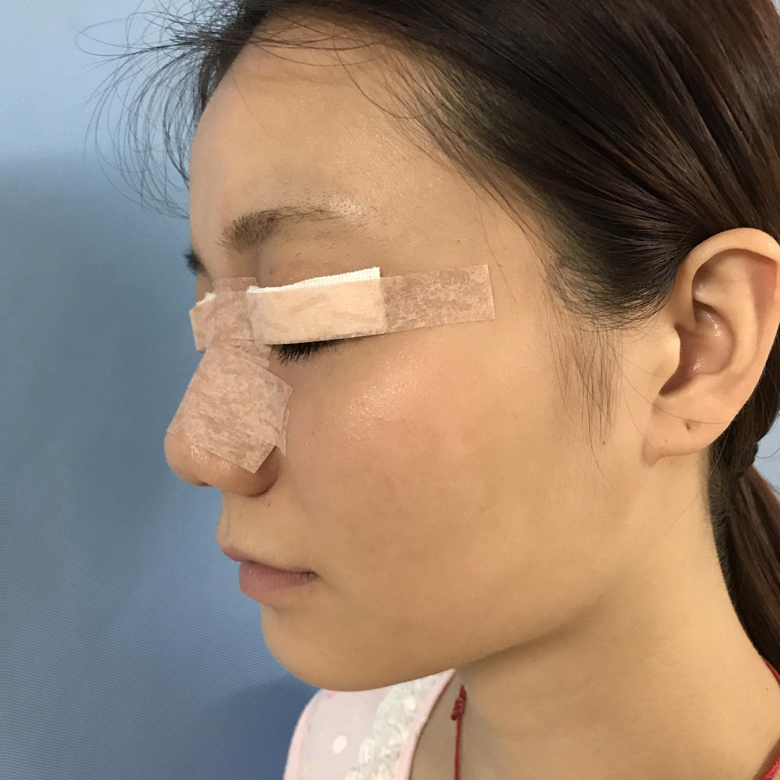武漢華美整形醫(yī)院醫(yī)生王向陽做眼綜合整形怎么樣？附案例效果圖