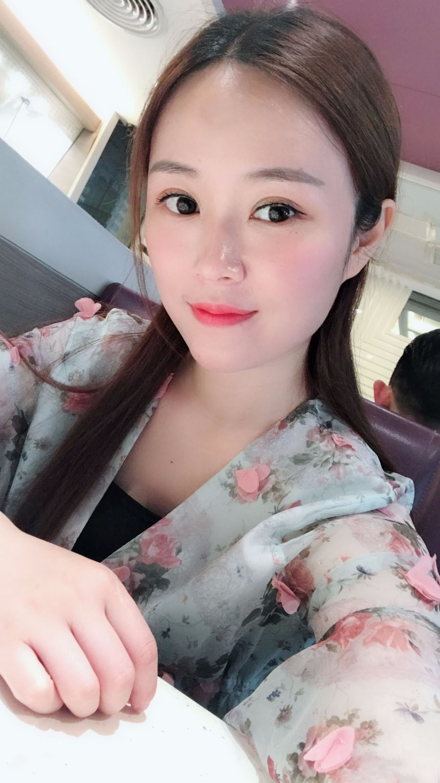 廣東韓妃醫(yī)療美容醫(yī)院做切開雙眼怎么樣？附案例效果圖
