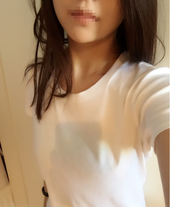 東莞韓美整形醫(yī)院醫(yī)生黃玉潔做假體隆胸怎么樣？附案例效果圖