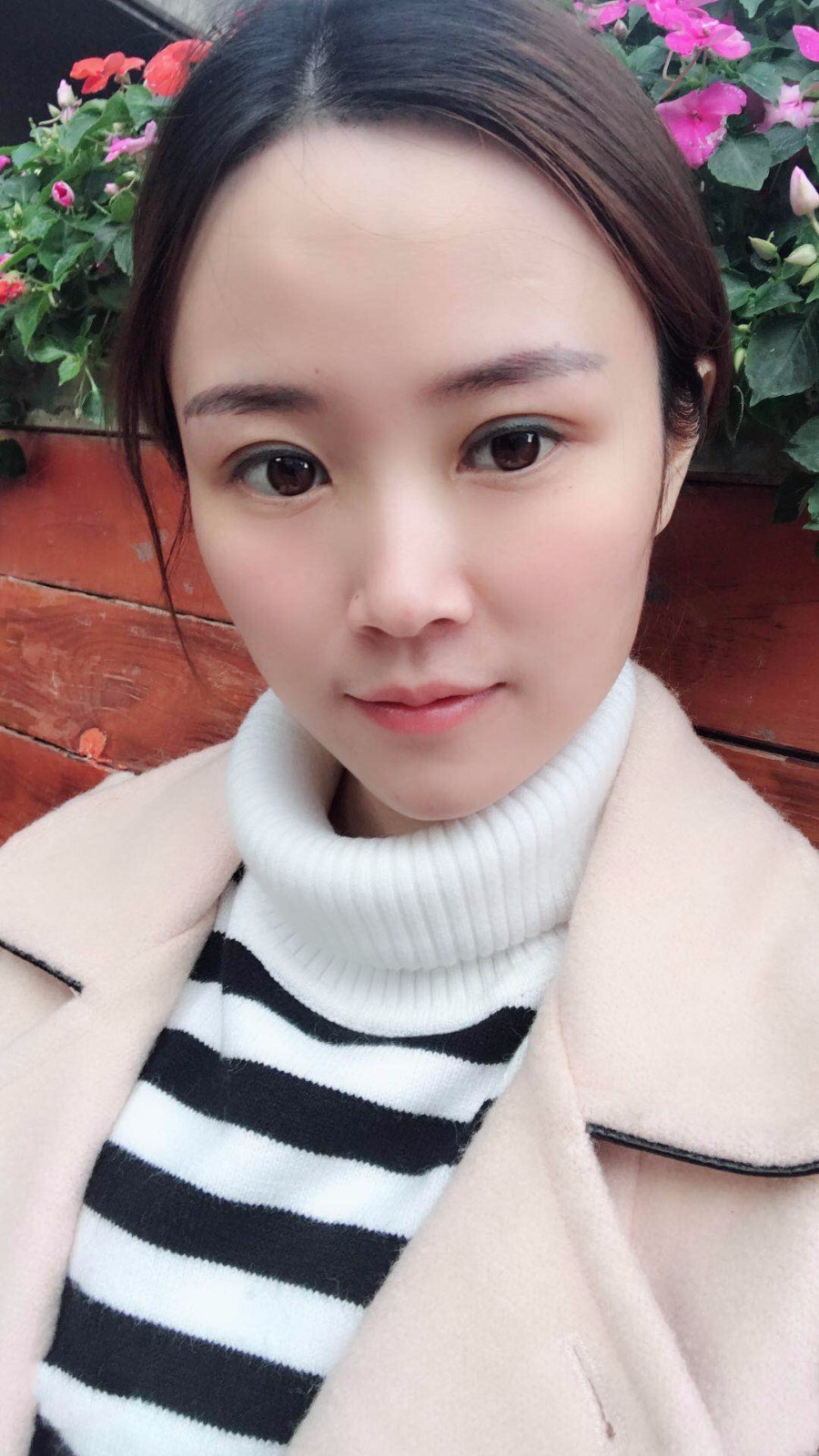 廣東韓妃醫(yī)療美容醫(yī)院做切開雙眼怎么樣？附案例效果圖