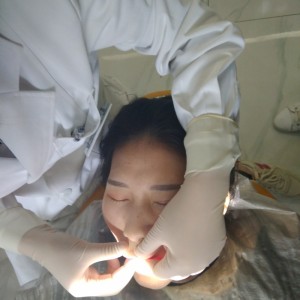 黔西南興義京州口腔醫(yī)院醫(yī)生徐勇做牙貼面怎么樣？附案例效果對比圖