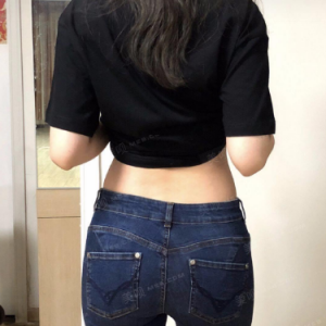 北京可思美整形醫(yī)院醫(yī)生斯勤做腰腹吸脂怎么樣？附案例效果對比圖