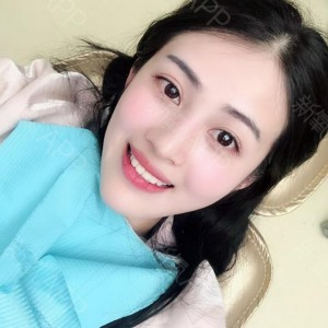 上?？仆呖谇会t(yī)院醫(yī)生鄧建儒做牙齒冷光美白怎么樣？附案例效果對(duì)比圖