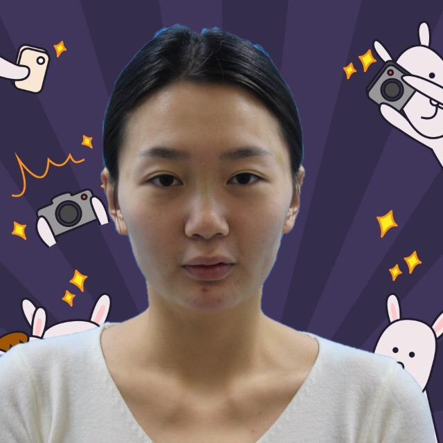 杭州格萊美整形美容醫(yī)院醫(yī)生張霞飛做自體脂肪全臉填充效果怎么樣？