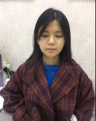 上海時(shí)光整形外科醫(yī)院醫(yī)生何晉龍做假體隆胸怎么樣？附案例效果對(duì)比圖