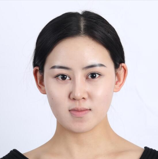 上海時(shí)光整形外科醫(yī)院醫(yī)生李靜林做假體隆鼻和反頜手術(shù)怎么樣？
