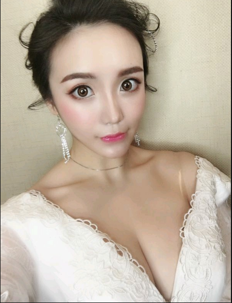 重慶當(dāng)代整形美容醫(yī)院醫(yī)生楊健做假體隆胸怎么樣？附案例