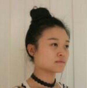 鄭州管城中醫(yī)院整形美容中心醫(yī)生張秀英做注射瘦臉怎么樣？附除皺瘦臉案例效果圖