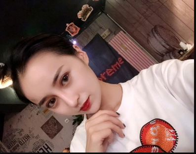 武漢米蘭醫(yī)療美容醫(yī)生柳再億做眼綜合+鼻綜合整形怎么樣？附真實(shí)案例對(duì)比圖