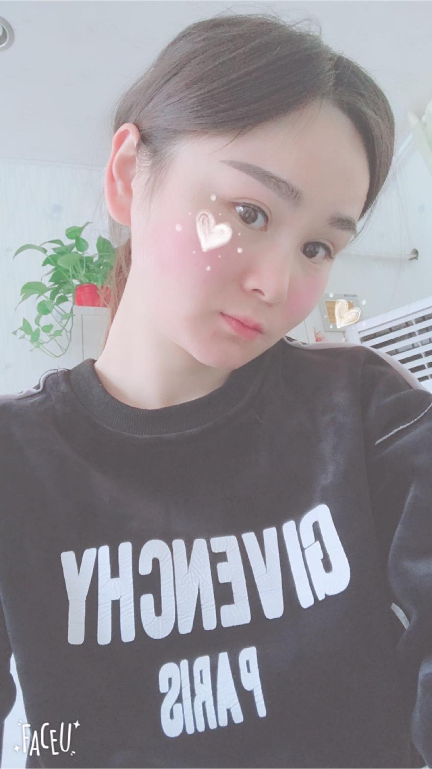 北京彤美美容整形醫(yī)院醫(yī)生楊曉惠做顴骨內(nèi)推+面部吸脂手術(shù)效果怎么樣？附案例