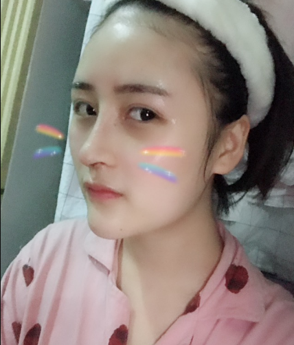 北京伊美爾美容愛康醫(yī)院醫(yī)生柳成做鼻綜合整形怎么樣？附案例效果圖