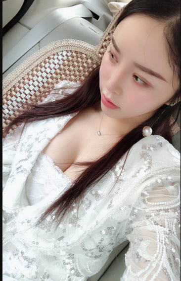 吉林現(xiàn)代整形美容醫(yī)院做假體隆胸效果怎么樣？附醫(yī)院案例效果對比圖