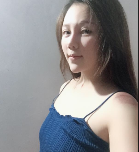 北京東方和諧醫(yī)療整形診所馮斌醫(yī)生做假體隆胸怎么樣？附案例效果對比圖