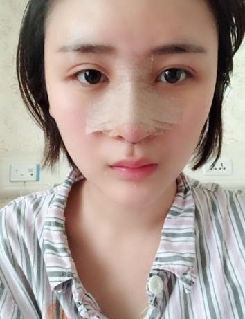 北京伊美爾美容愛康醫(yī)院醫(yī)生柳成做鼻綜合整形怎么樣？附案例效果圖