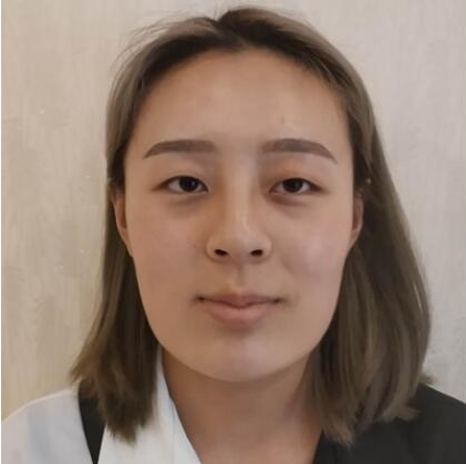 上海時(shí)光整形醫(yī)院做雙眼皮怎么樣？附石重明醫(yī)生雙眼皮+隆鼻+下頜角磨骨案例效果對(duì)比圖