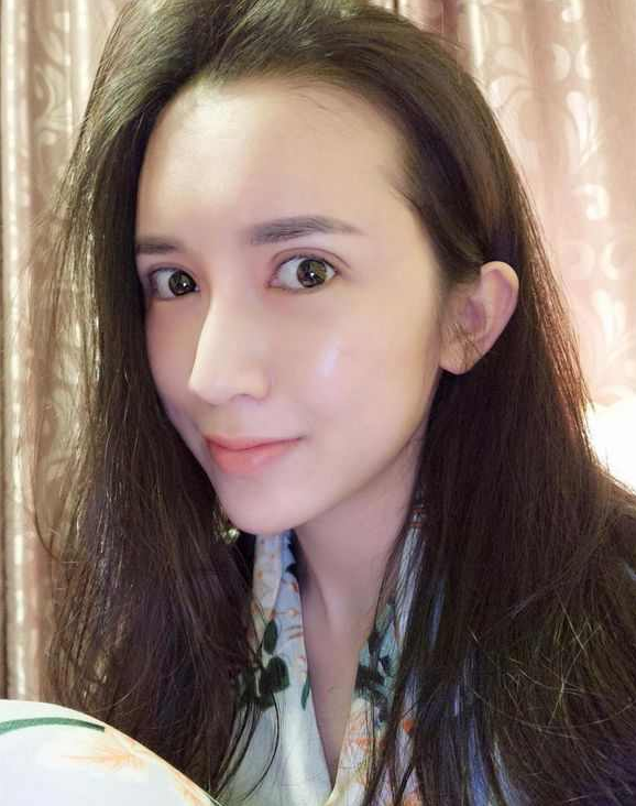 上海時光整形醫(yī)院張晶醫(yī)生做開眼角怎么樣？附真實效果圖