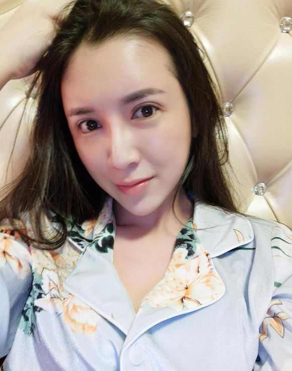 上海時光整形醫(yī)院張晶醫(yī)生做開眼角怎么樣？附真實效果圖