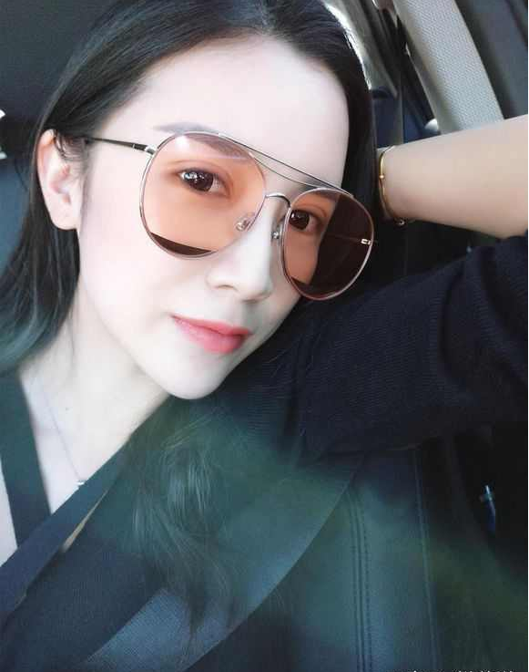上海時光整形醫(yī)院張晶醫(yī)生做開眼角怎么樣？附真實效果圖
