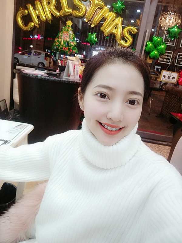 巴中華醫(yī)口腔醫(yī)院做牙齒矯正效果好嗎？附母汶靈醫(yī)生牙齒矯正案例效果圖