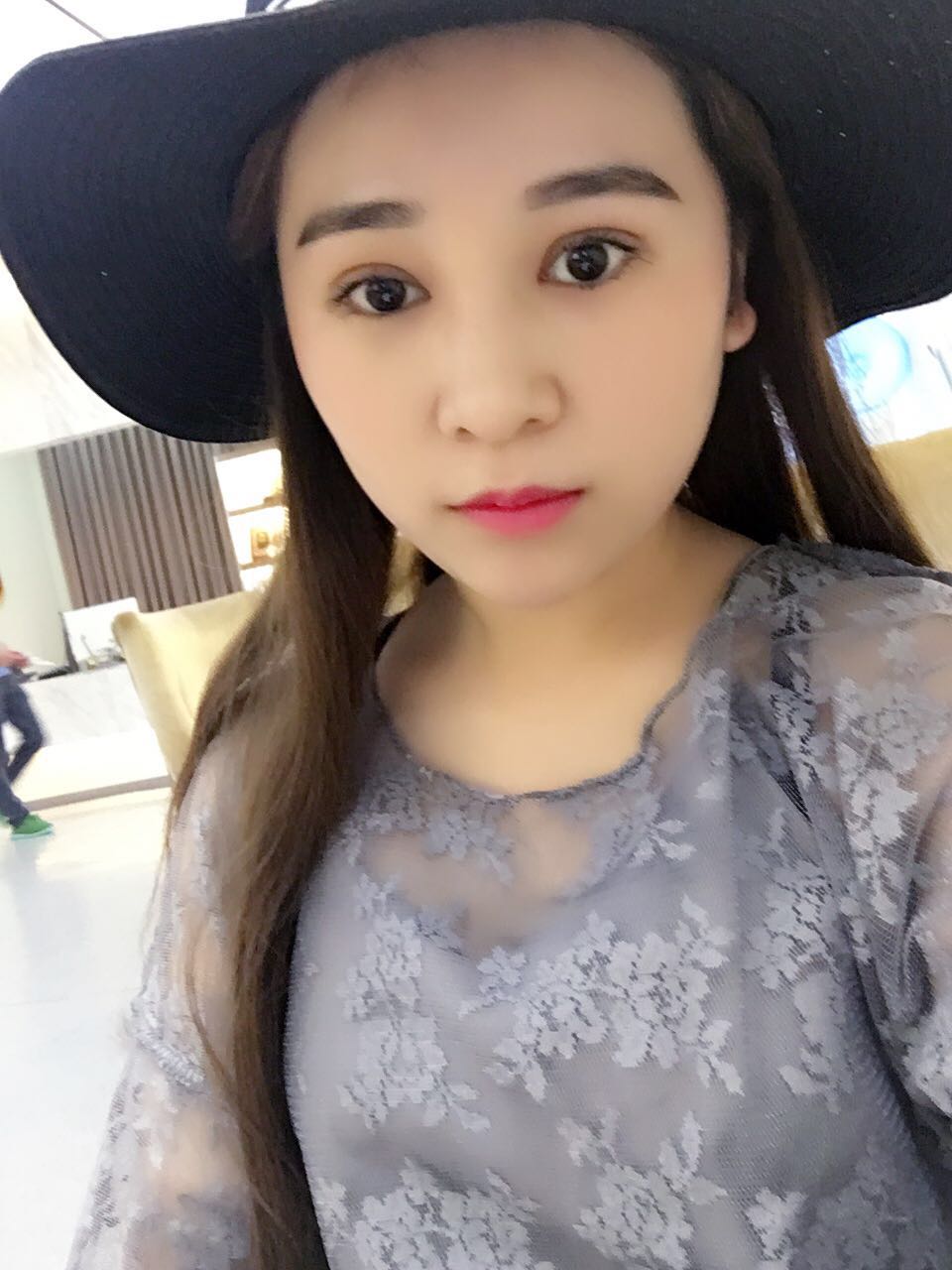 蚌埠韓美美萊整形醫(yī)生鄭捷做開(kāi)眼角怎么樣？附案例效果圖
