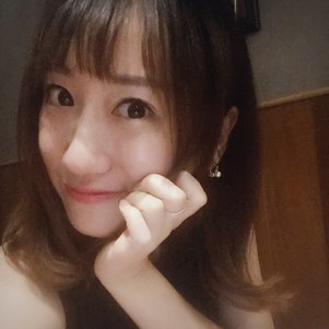 蚌埠韓美美萊整形做玻尿酸面部除皺效果怎么樣？附陳澤醫(yī)生案例效果圖